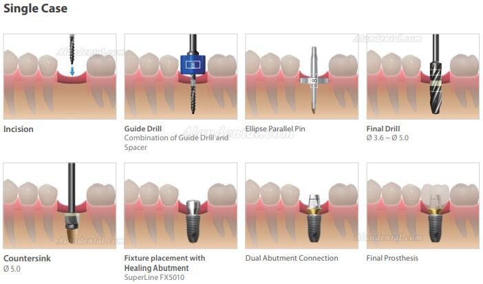 Dentium Implant Guide Kit (ISGK Kit) / Dental Instrument Kit